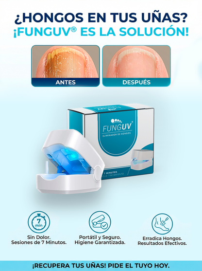FUNGUV®| Tratamiento Láser UV para hongos en uñas