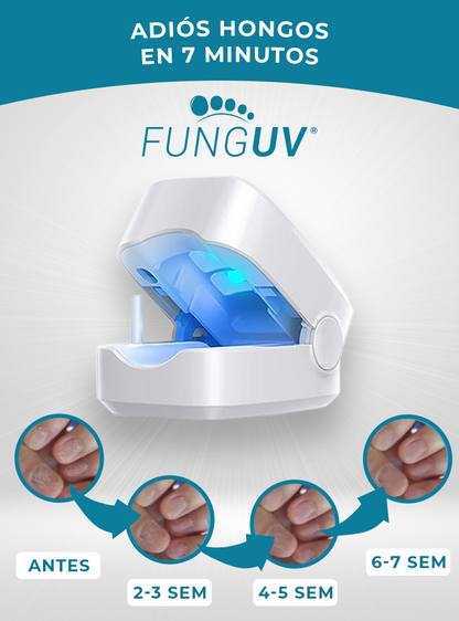 FUNGUV®| Tratamiento Láser UV para hongos en uñas