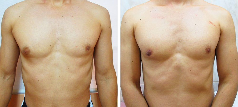 files/modelado-pectoral-1.jpg